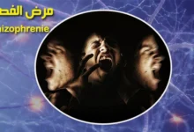 بحث جاهز عن الفصام أو الشيزوفرينيا pdf