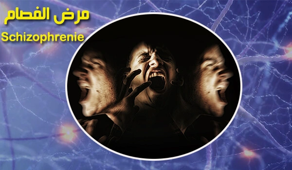 بحث جاهز عن الفصام أو الشيزوفرينيا pdf